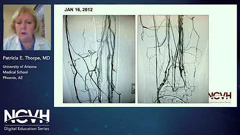 Dr. Patricia Thorpe, Tips and Tricks to Cross Tota...