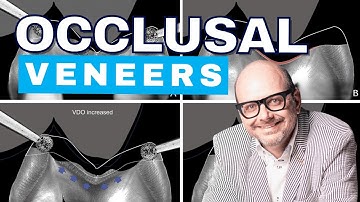 Pascal Magne on Occlusal Veneers and Material Selection - PDP221