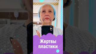Жертвы пластики, которые довольны результатом: мама Бони и Гоар Аветисян #пластика