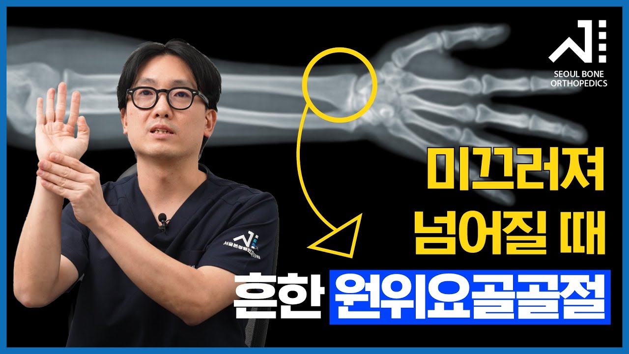 미끄러져 넘어질 때 흔한 원위요골골절 - YouTube
