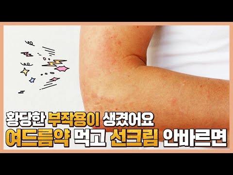 여드름약과 항생제를 복용할때 외출전 자외선차단제를 반드시 발라야 되는 이유
