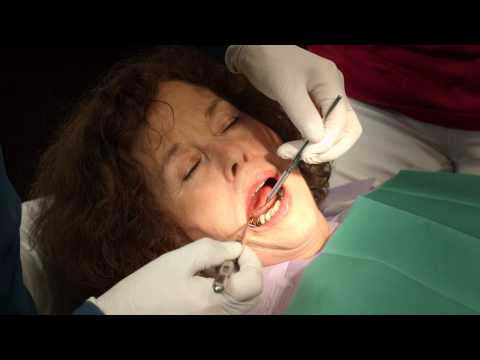 Video: Acute En Chronische Parodontitis - Behandeling, Symptomen