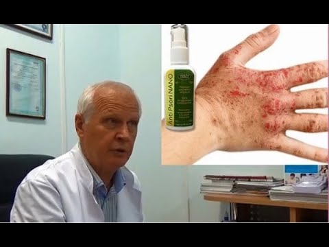 Лечение псориаза -  нано гель, мазь Король кожи, Монастырский чай