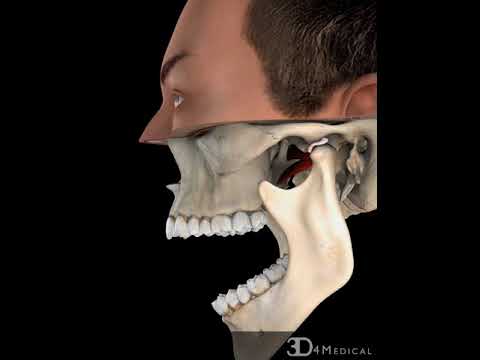 Video: Adakah komponen sendi temporomandibular?