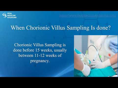 &ldquo;Let's Discuss About Chorionic Villus Sampling with Dr  Neha Gupta&rdquo;-Fetal Medicine Specialist