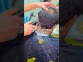 Non Surgical Hair Patch Thinning Crown Area to Achieve Sober Look With Hair Patch Call on-9926978311