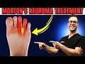 Numbness or tingling in the feet or toes mortons neuroma treatment
