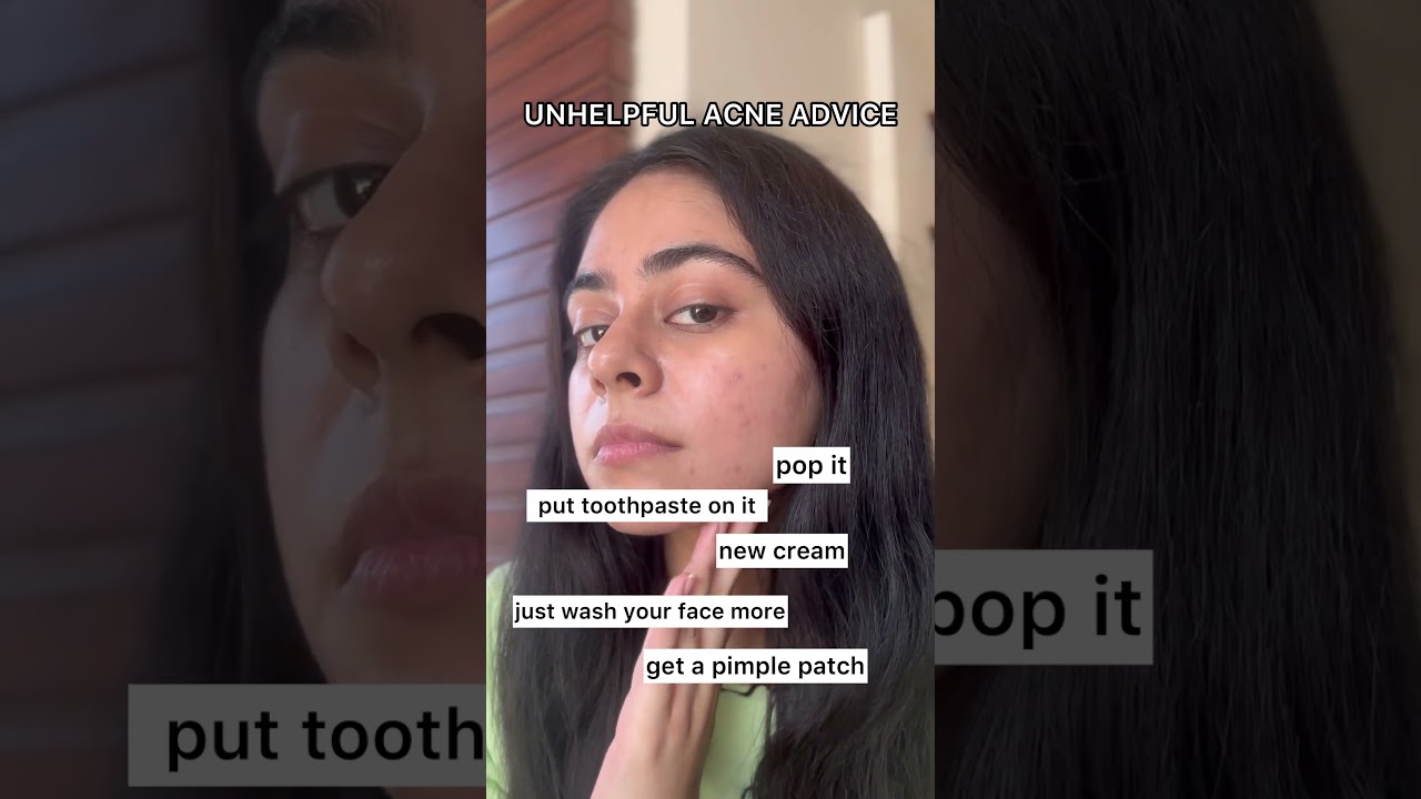 Best face pack for Acne prone skin | Dermatologist formulated | Acne Control Mask