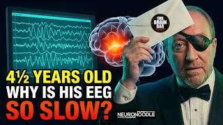 Why Is This 4½-Year-Old's EEG So Slow? | NeuroNoodle Neurofeedback Therapy Podcast