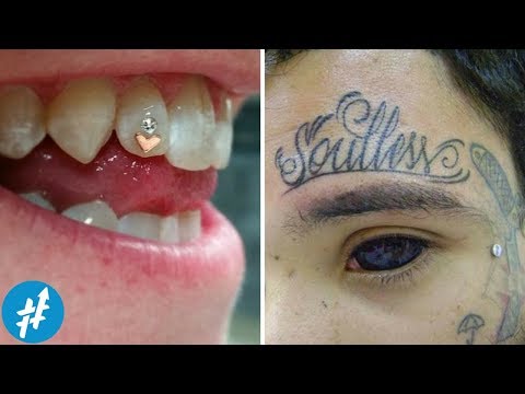 Video: Semua Mengenai Menindik Gigi: Prosedur, Gambar, Komplikasi