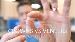 CROWNS VS VENEERS - Which is best? 