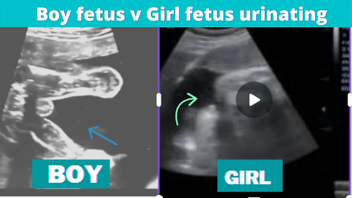 Baby girl vs baby boy captured urinating inside womb on Ultrasound! - DayDayNews