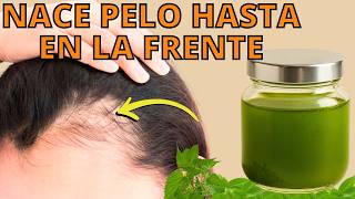 Crece Tu Cabello Como Loco En Dias Y No Se Caecon Ingredientes Naturalesoro Puro Para Tu Pelo
