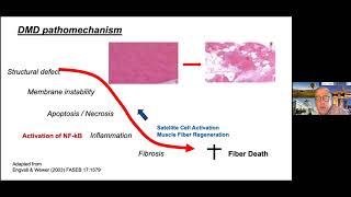 Potential Biomarkers and New Therapies for Duchenne Muscular Dystrophy