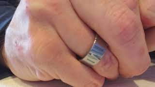 Celebrity Injector seals without special tools mk6 gti Net Worth