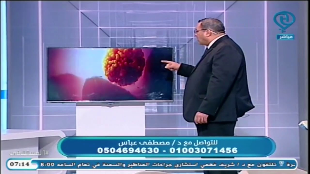 دكتور مصطفى عباس يتحدث عن العقم وأثر الدوالى على الخصوبه على قناة IMC