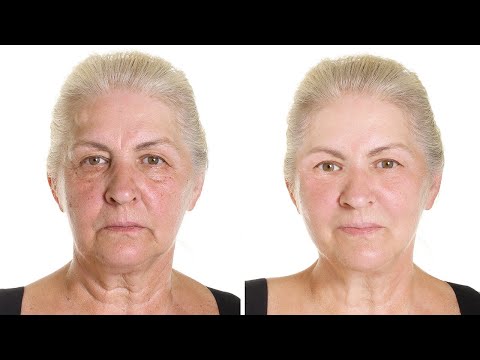 Wideo: Jak uzyskać jasną skórę: czy naturalne środki mogą pomóc?