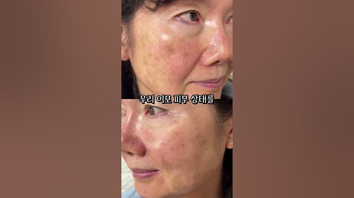 이 크림 하나만 바르면 피부과보다 효과가 좋다고?#화장품 #피부 #안티에이징 #주름개선 #기미잡티 #노화방지 #검버섯 #beauty #피부좋아지는법 #퓨어라이트