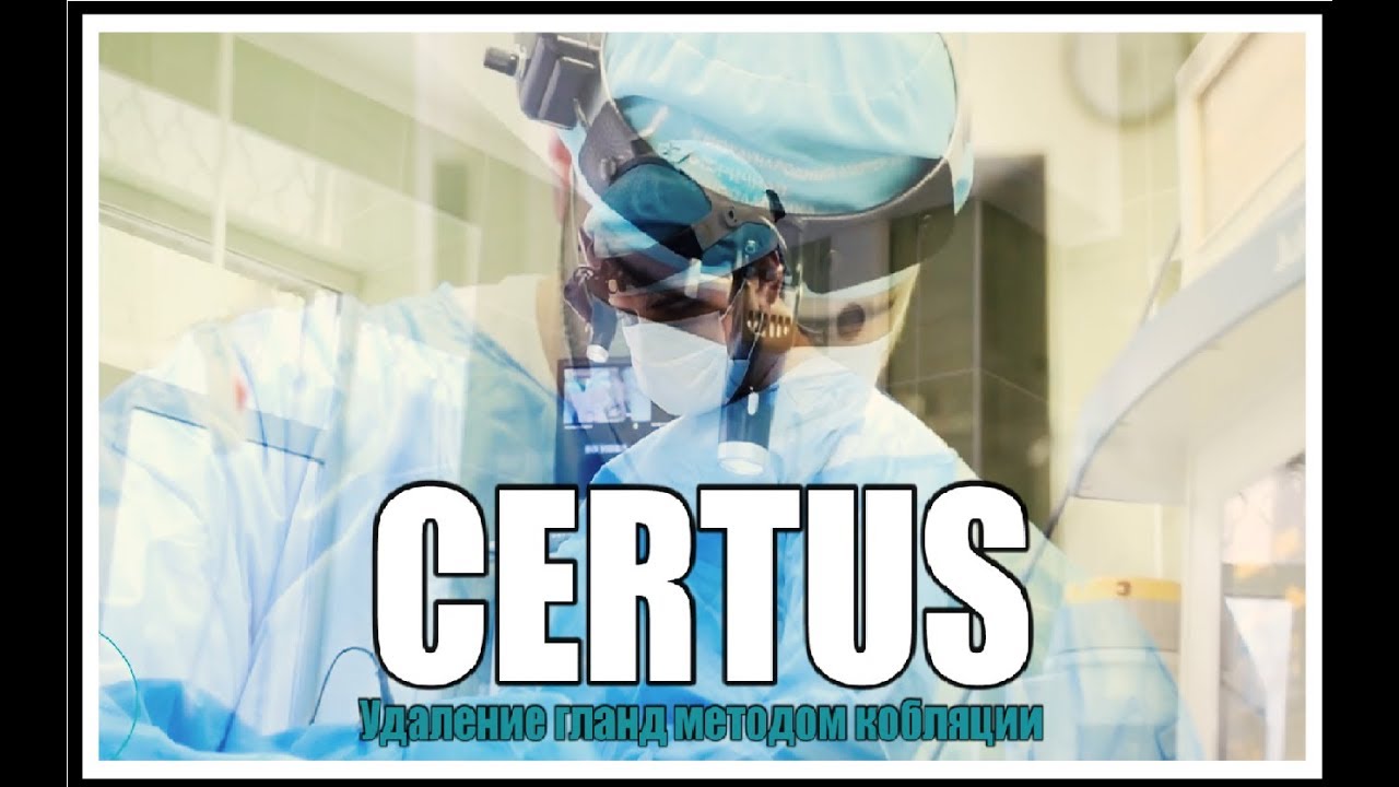 Удаление гланд методом кобляции - YouTube