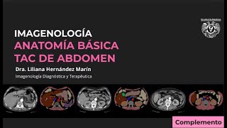 TAC DE ABDOMEN  ANATOMÍA RADIOLÓGICA BÁSICA