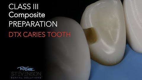CLASS III Composite Preparation #7 DL DTX