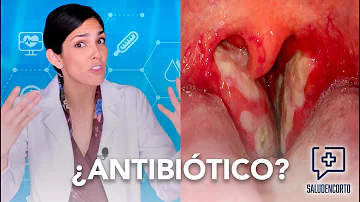 ¿Por qué los médicos no dan antibióticos para las infecciones?
