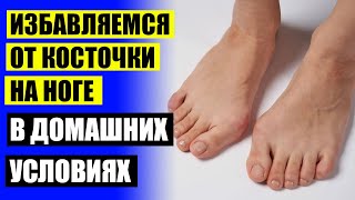 👣 Вальгус стоп у взрослых как лечить 🎯 Вальгусный корректор для большого пальца ⭐