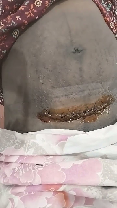 Ceserian dressing in live