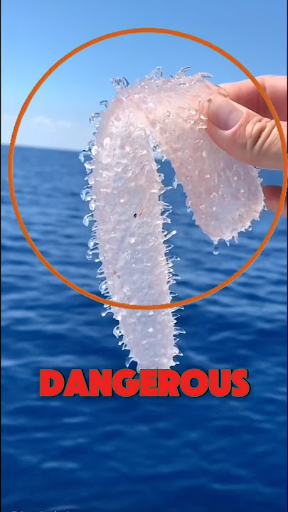 Most Dangerous Sea Creature 😱