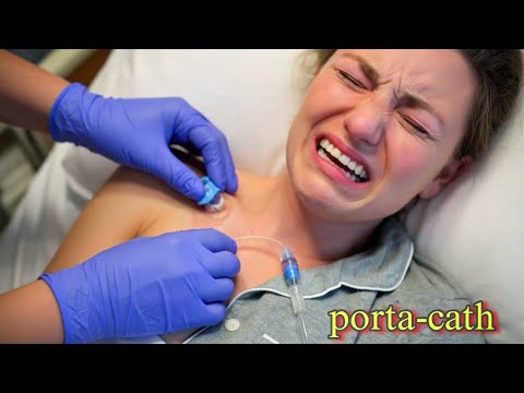 كيفية تركيب بورت كاث    لمريض العلاج الكيماوي شرح عملي ومبسط