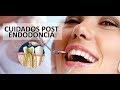 QUÉ CUIDADOS DEBES TENER DESPUÉS DE UNA ENDODONCIA