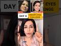 Day 4 | Lift Droopy Eyes Challenge ✨ #DroopyEyes #FaceYoga #AntiAging