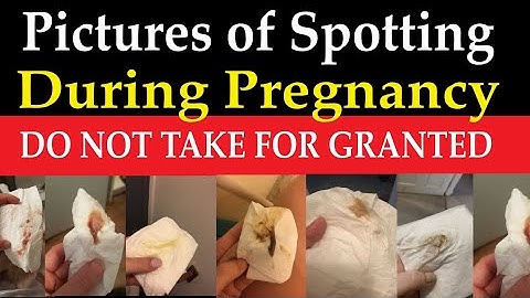 Brown discharge pictures of spotting during pregnancy