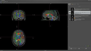 BrainMagix Diffusion Module