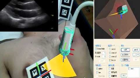 Remote Instruction for Echography using AR Technology