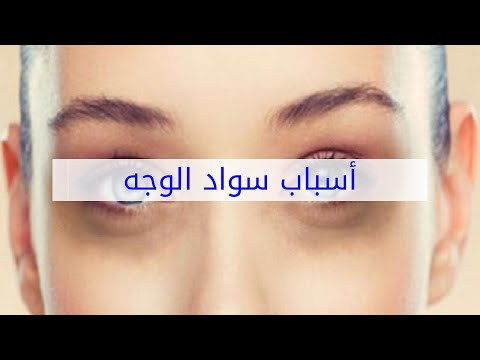 أسباب سواد الوجه