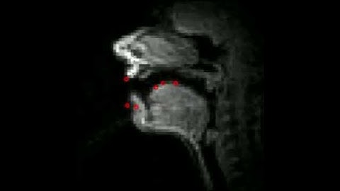 Initial alignment result of real-time MRI video and EMA sensors