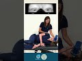 Side Lying Test for Left Posterior Canal BPPV 🌀