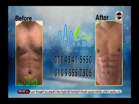 جمالك كيفية استعادة نضارة الوجه مع د نهلة الهميسى