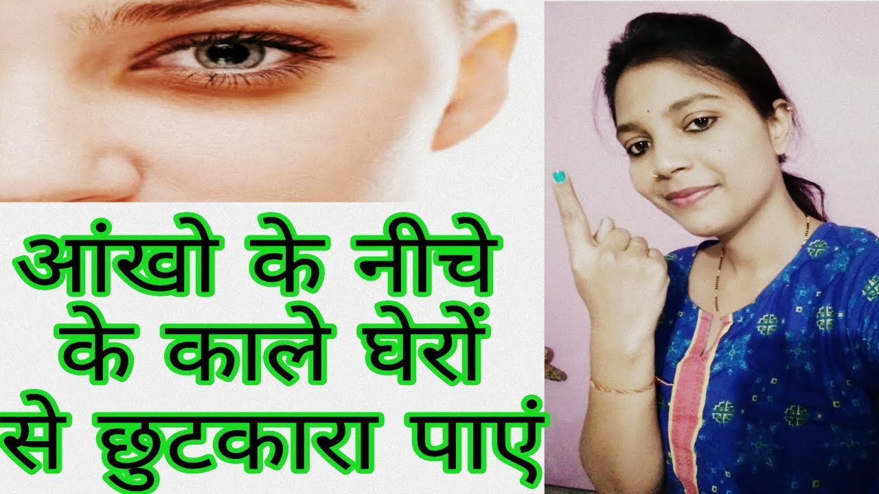 dark circles treatment in homeopathy