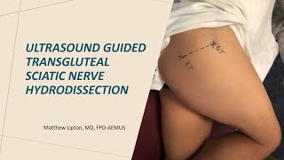 Transgluteal sciatic nerve hydrodissection: the new procedure to treat sciatica in the ED?