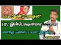 Hsv infection to change hiv in tamil doctor satheesh  yes1tv tamil