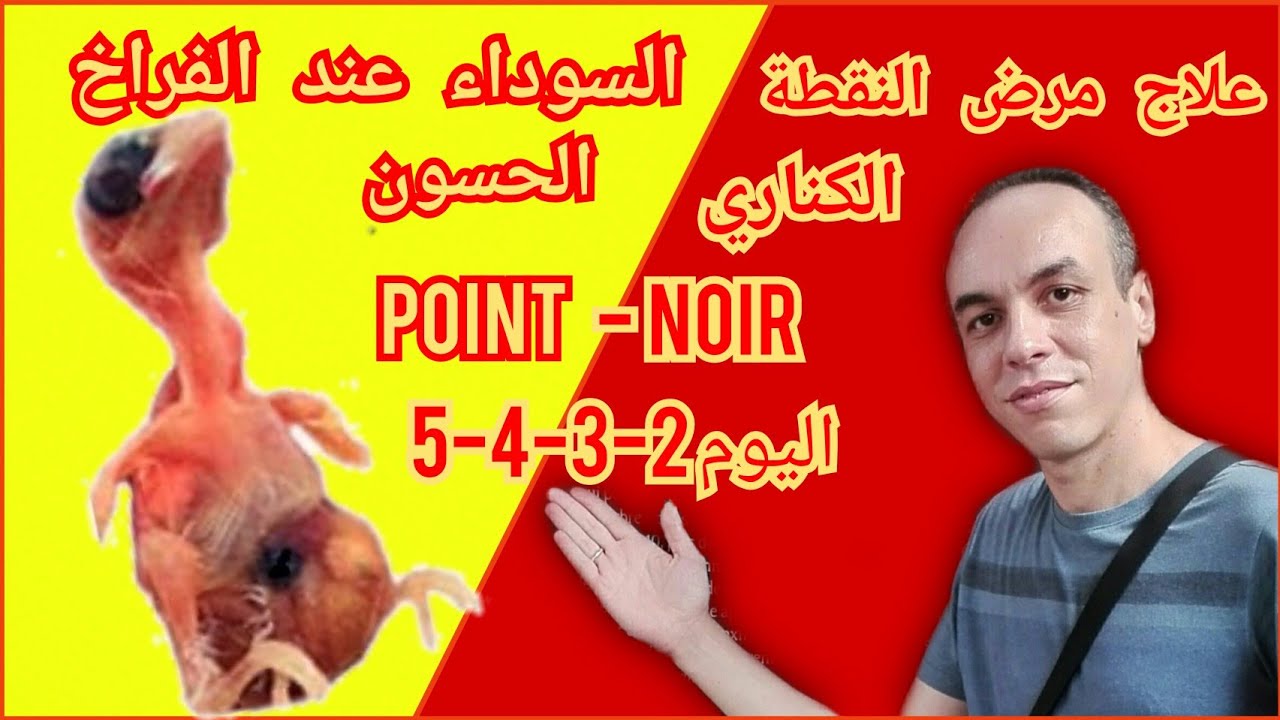 علاج النقطة السوداء اليوم التاني و الٹالت