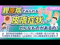 膠原病でみられる皮膚症状ってどんなものがあるの PART2 混合性結合組織病 シェーグレン症候群 成人Still病 血管炎 医師解説 膠原病でみられる皮膚症状ってどんなものがあるの PART2 混合性結合組織病 シェーグレン症候群 成人Still病 血管炎 医師解説