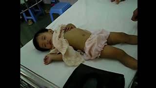 Giật Mình Trong Bệnh Tay Chân Miệng Online Video Cutter Com