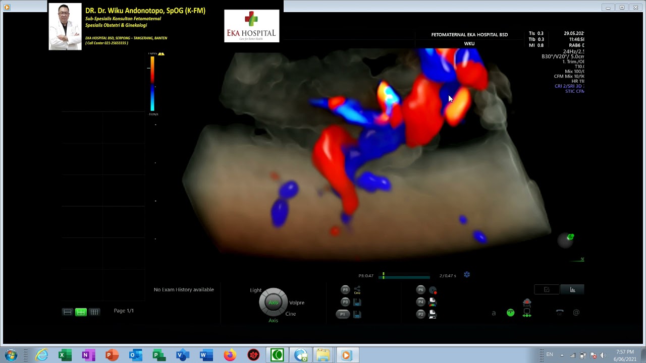 PLASENTA DAN PANGKAL TALI PUSAT (Dr Wiku Andonotopo)