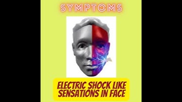 Trigeminal Neuralgia: A neurological disorder causing severe pain in half of the face.