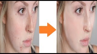 How to clean face in photoshop cs6 urdu hindi screenshot 3