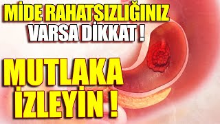 Mide Kanserinden Korunmanın 12 Yolu...