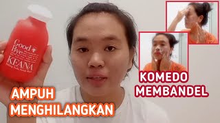 Download lagu REVIEW KEANA || BEKING SODA UNTUK KOMEDO YANG MEMBANDEL